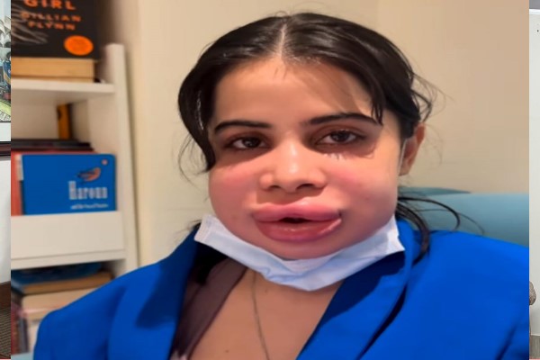 এ কী অবস্থা উর্ফীর