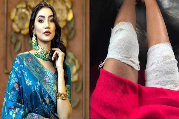 আহত অভিনেত্রী সুনেরাহ